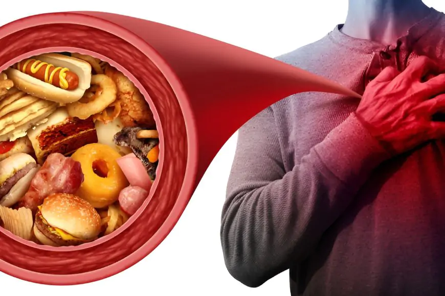 Junk food leading to heart disease risk illustration - SAAOL Delhi