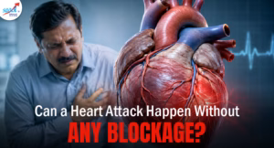 featured image of heart attack with no blockage