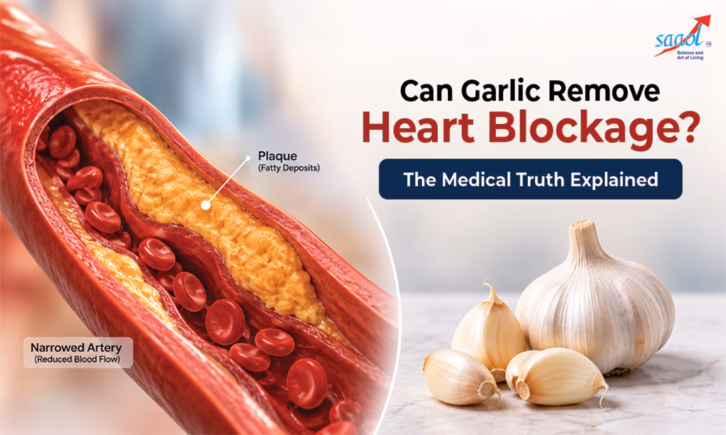 Featured image of Can Garlic Really Remove Heart Blockage?