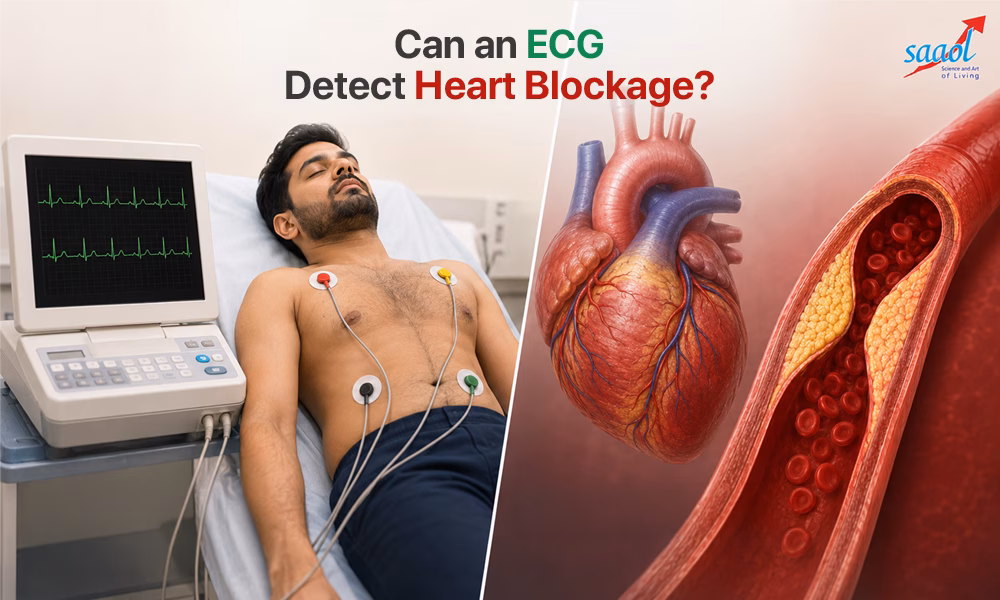 Can an ECG Detect Heart Blockage?