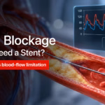 Ultra-realistic 3D coronary artery with a visible narrowing caused by plaque. Show a thin pressure-sensing wire passing through the narrowed section, with a subtle pressure/FFR reading on the side.